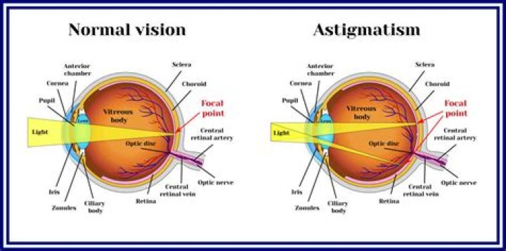 Photo Comparison Of Astigmatism At Night Mystical Raven Mystical Raven