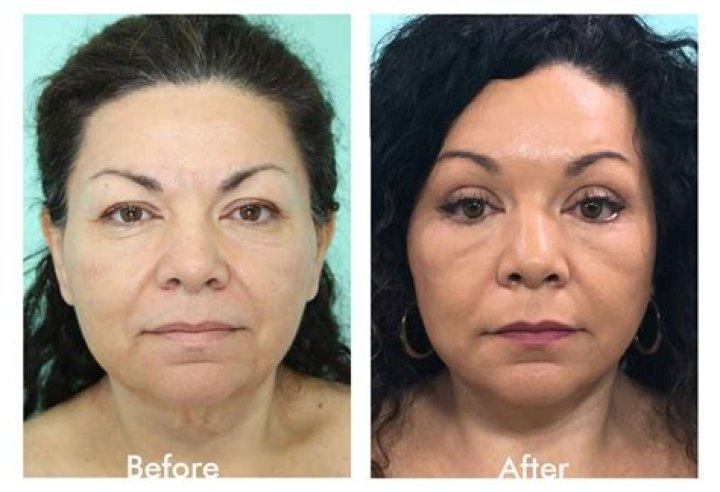 Plastic Surgery Tijuana Top Plastic Surgeon Mexico