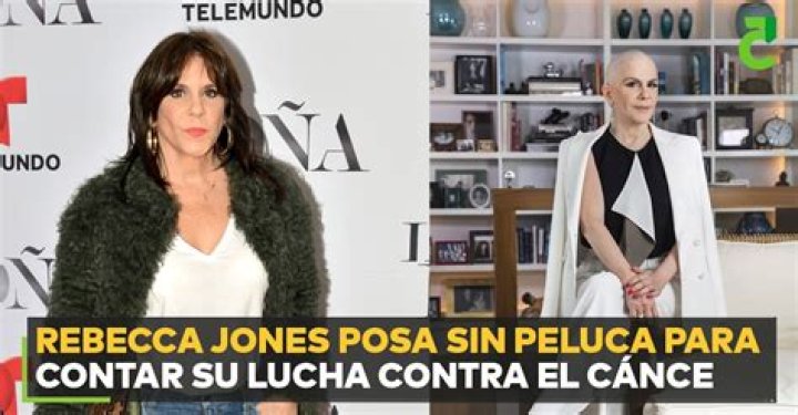 Rebecca Jones posa sin peluca y narra su lucha contra el c&aacute;ncer de