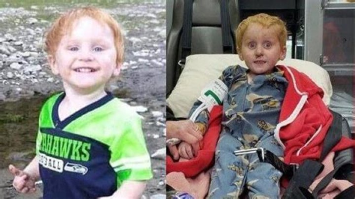 Ryker Webb Before And After Photos