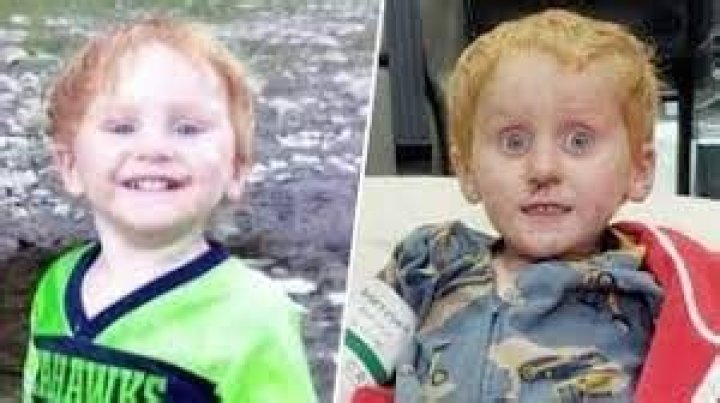 Ryker Webb Now Before And After of Ryker Webb