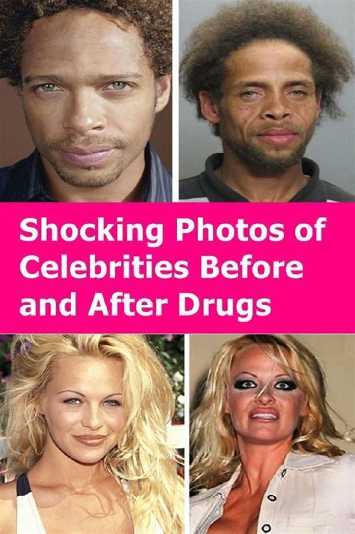 Shocking celebrity faces before and after Khloe Kardashian, Kim
