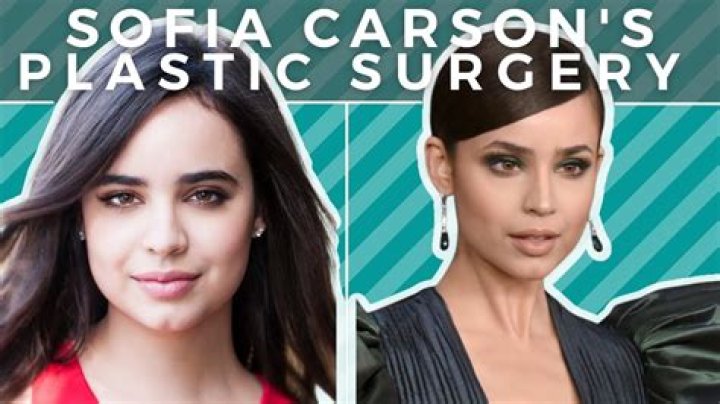 Sofia Carson before and after