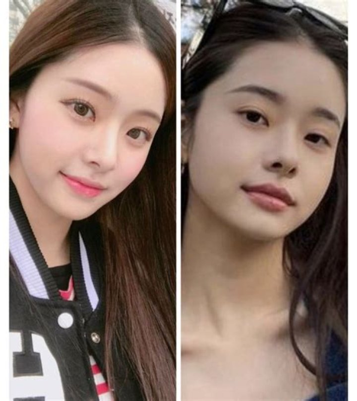 Song Joo Ah Plastic Surgery Song Yoon Ah Wikipedia Kaci Kessler