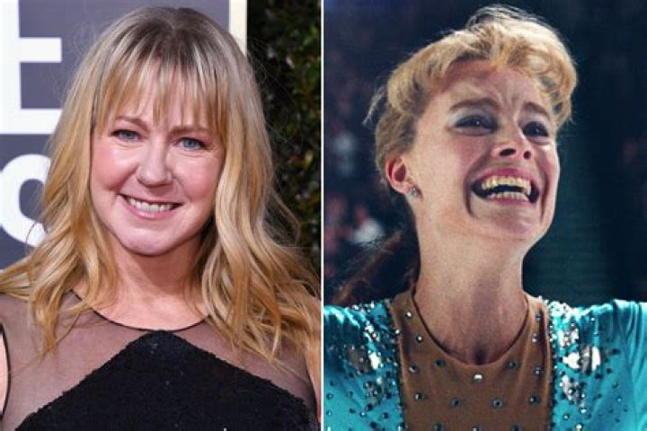 Tonya Harding Before and After Plastic Surgery Facelift, Nose Job