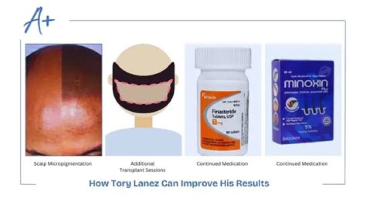 Tory Lanez Can't Be Stopped in 2016 XXL