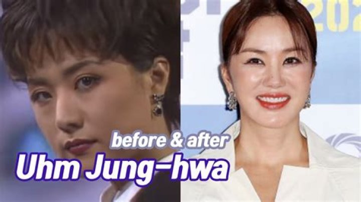 Uhm Jung Hwa Plastic Surgery Uhm JungHwa Before And After 모든 답변 Ro