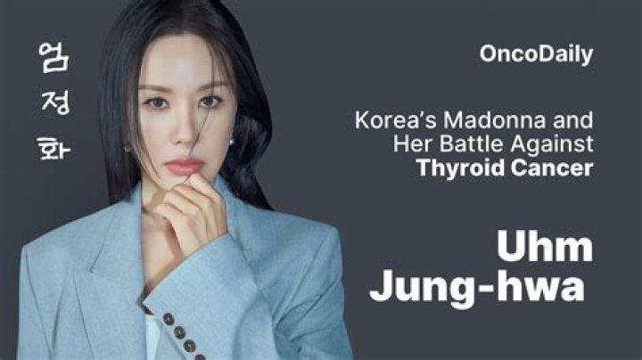 Uhm Junghwa (Singer) Age, Bio,Wiki, Facts & More Kpop Members Bio