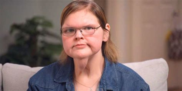 What Happened To Tammy Slaton Forehead In 1000lb Sisters? Trendzified