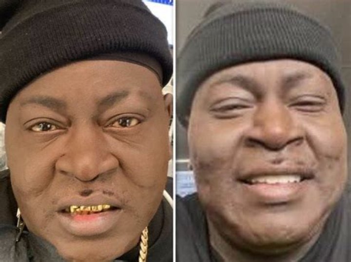 What Happened to Trick Daddy's Face? Lupus Diagnosis, Mugshot