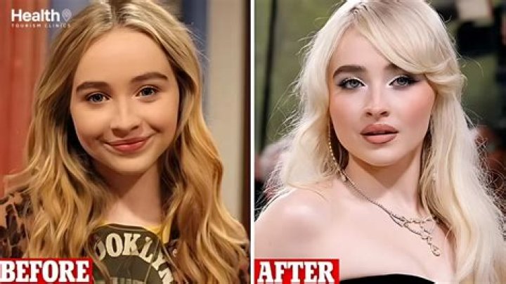 What Plastic Surgery Has Sabrina Carpenter Gotten? Body Measurements