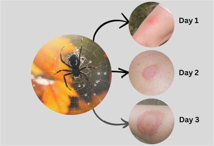 Why Spiders Suddenly Appear When You Turn on the Lights My Backyard Life